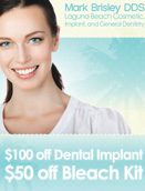 Dental Implant & Bleach Special